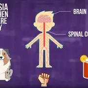 Paresthesia